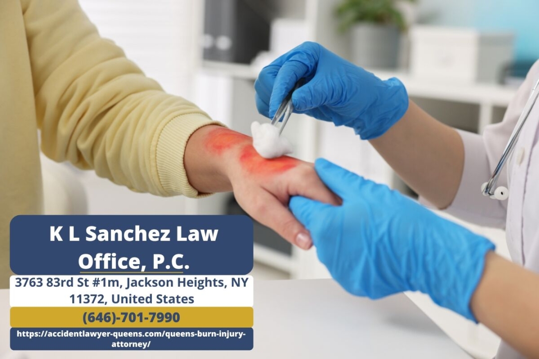 Queens Burn Injury Attorney Keetick L. Sanchez Discusses Legal Rights for Burn Victims