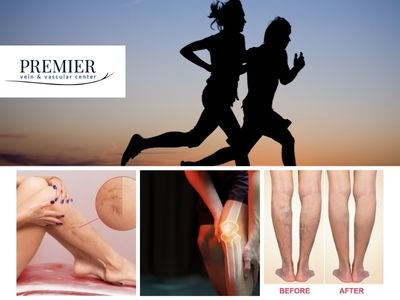 Premier Vein & Vascular Center: Houston’s Leading Destination for Expert Vein & Fibroid Treatments