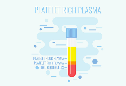 Platelet Rich Plasma Market Getting Larger With Great CAGR By 2026: Stryker, DePuy Synthes, T-Biotechnology, Arthrex, Terumo BCT, Arteriocyte Medical Systems, CellMedix, Zimmer Biomet