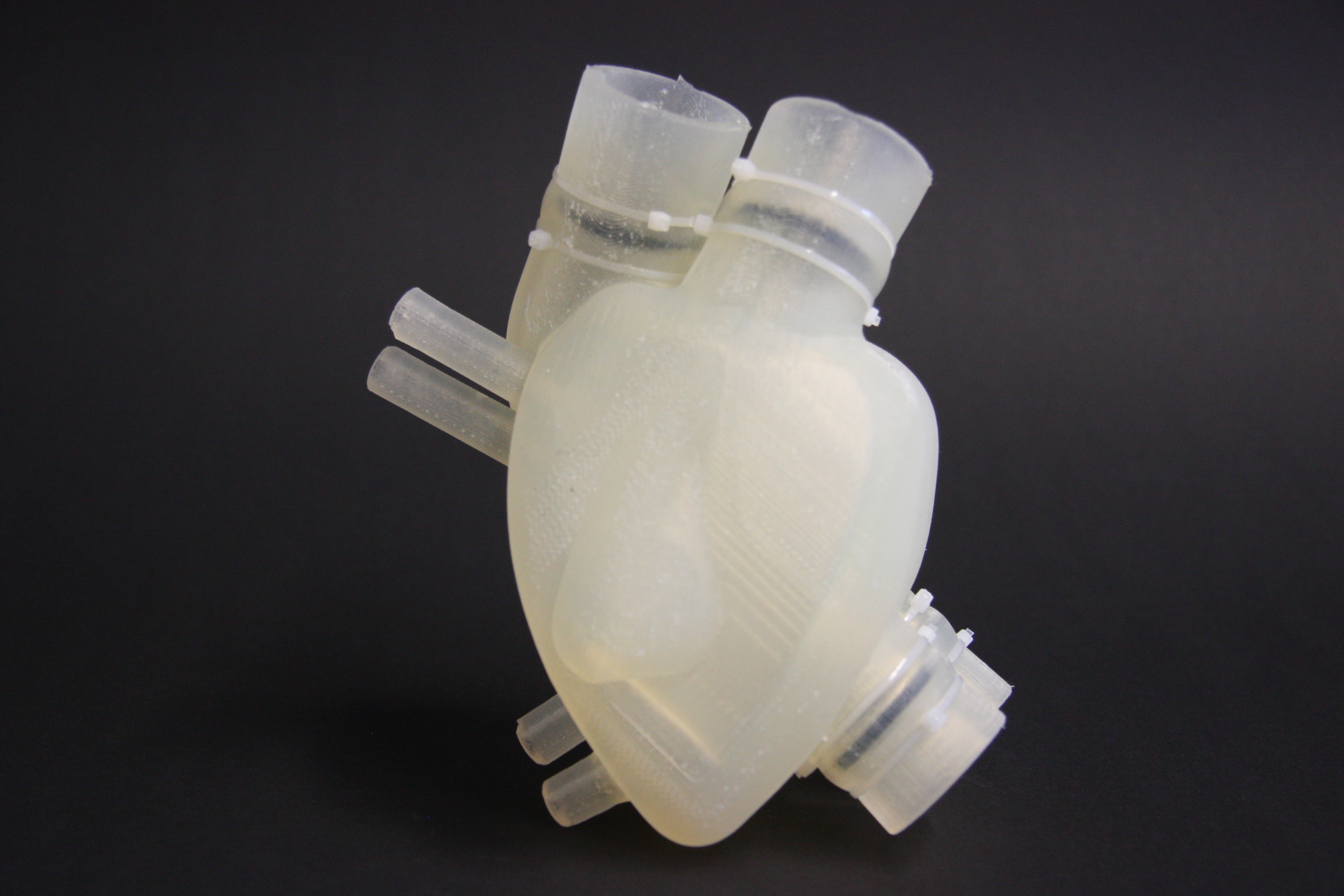 Increased Ratio of Heart Failure Is Predicted to Drive the Growth of The Global Artificial Heart Market, Global Industry Report, 2020 Trends, Top Company Analysis, Regional Outlook