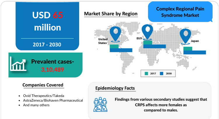 Complex Regional Pain Syndrome Market Insights and Treatment Market by DelveInsight