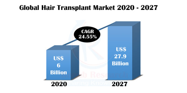 Hair Transplant Market, Global Forecast by Methods, Products, Therapy, Gender, Service Provider, Region, Company Analysis - Renub Research