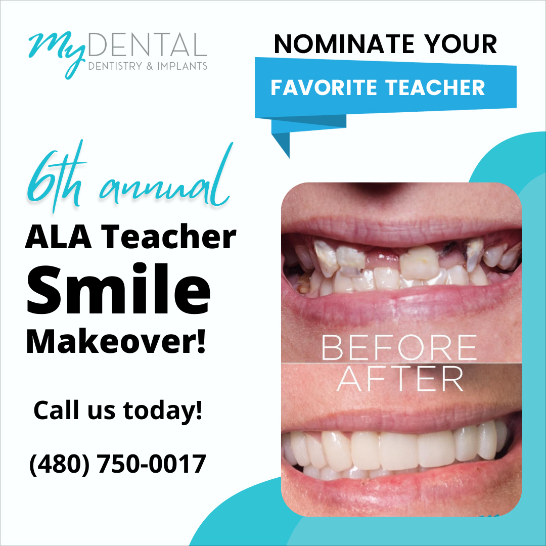 My Dental Dentistry & Implant Center 6th Annual Teacher Smile Makeover Announced 