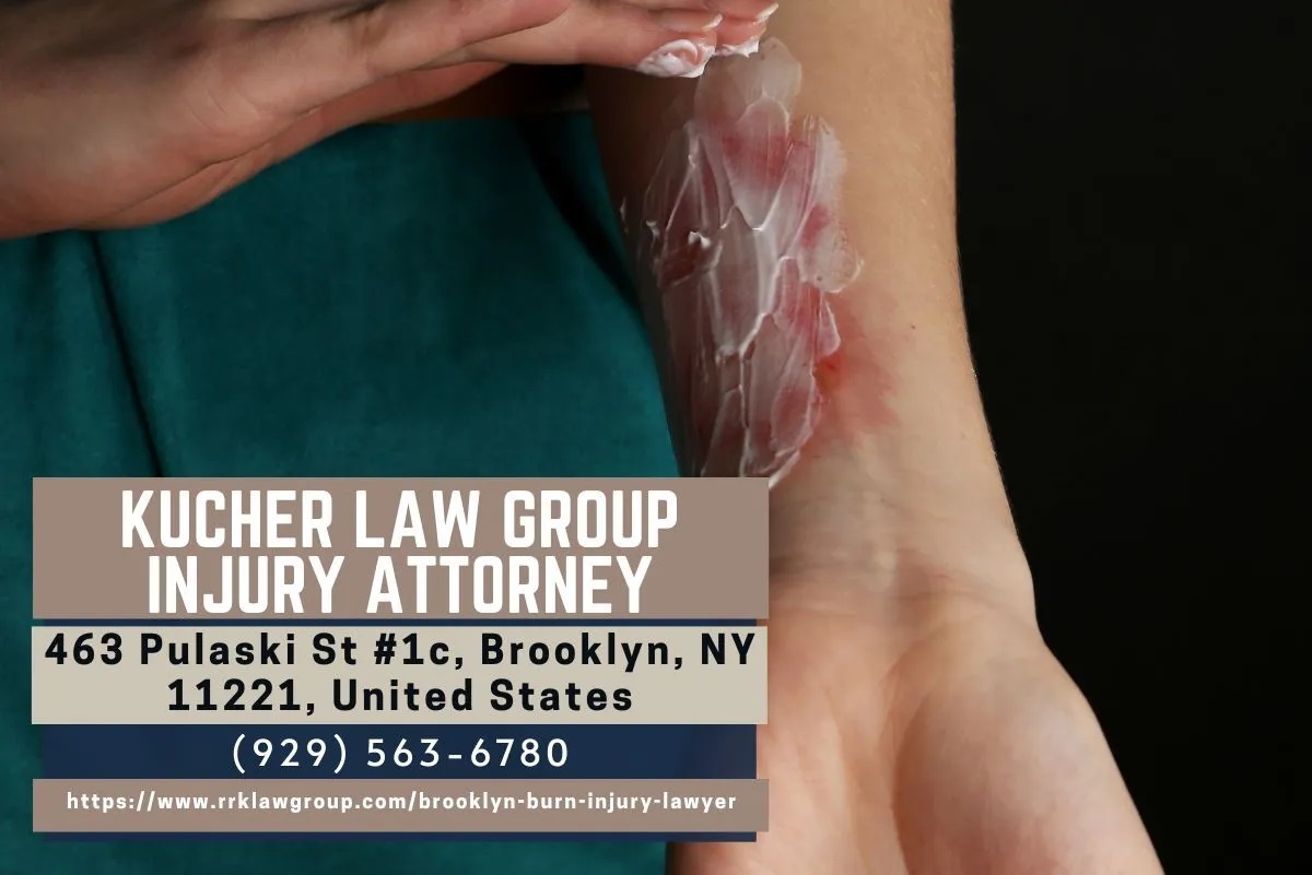 Burn Injury Lawyer Samantha Kucher Sheds Light on Burn Injury Accidents in New York
