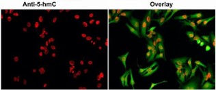 Creative Diagnostics Announces Cutting-Edge DNA/RNA Methylation Antibodies for Cancer Research