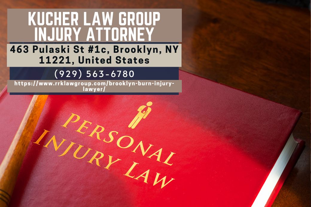 Brooklyn Burn Injury Lawyer Samantha Kucher Releases Article Discussing Burn Injury Claims