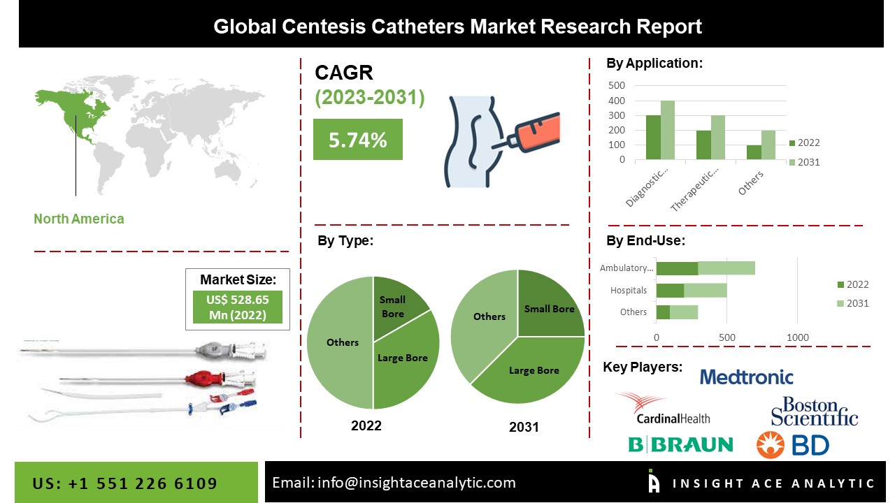 Centesis Catheters Market Set to Soar as Healthcare Technologies Advance