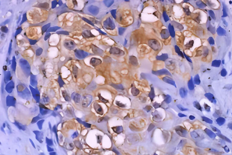 CD BioSciences Announces DS IHC Kits for Human and Rodent Tissues